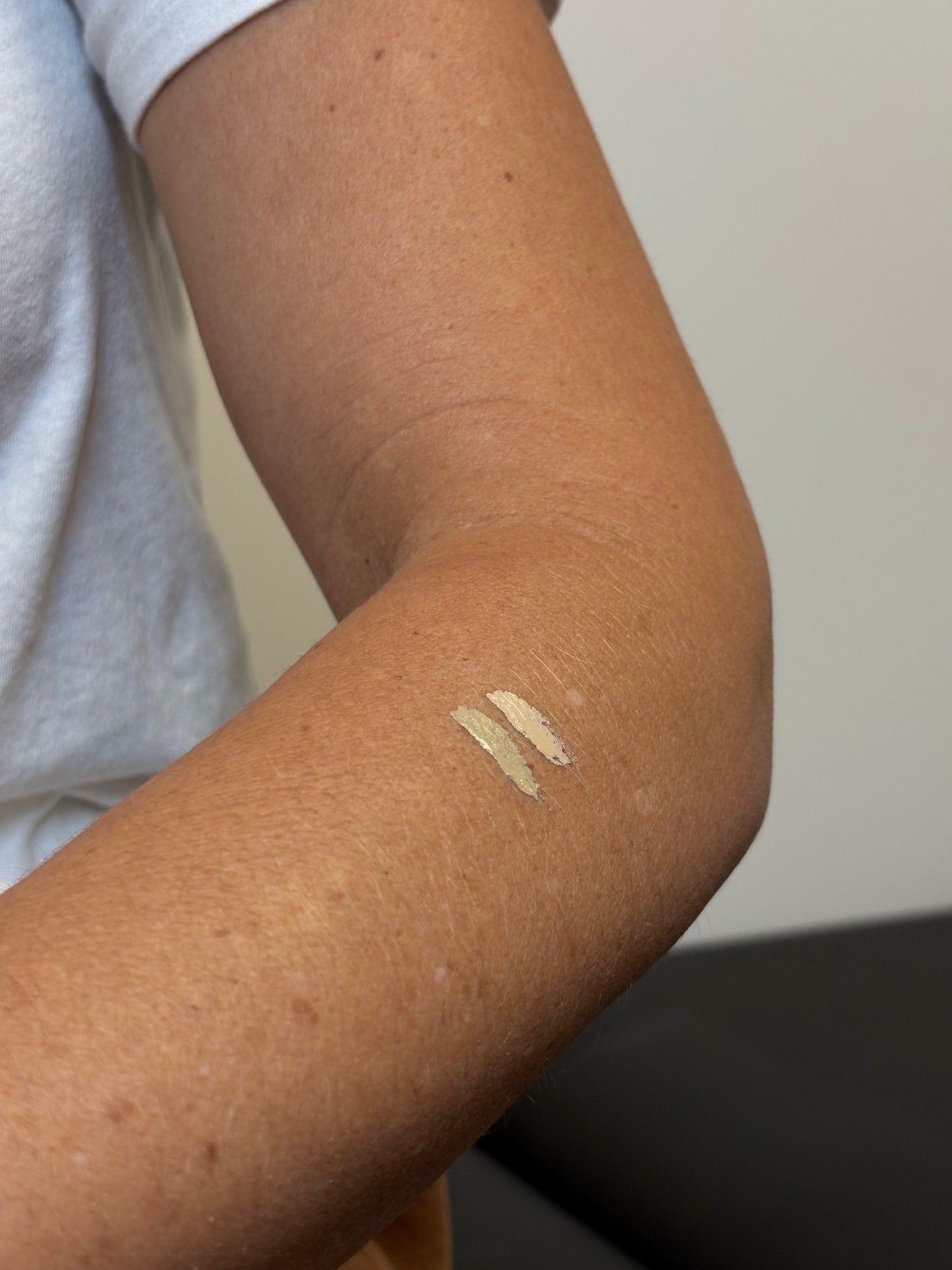 Scar & Stretch Mark Camouflauge